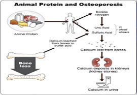 Chronic Kidney Disease and Osteoporosis